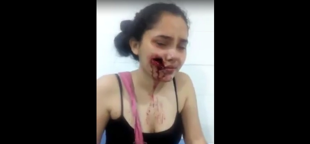  Indignación por agresión a joven mujer en Planeta Rica