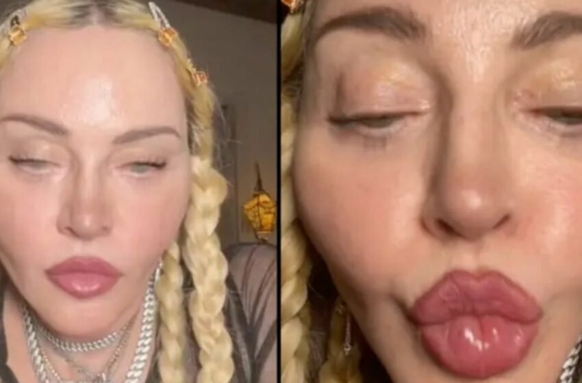 ¿Qué le pasó a Madonna? Video de la cantante causa impresión a sus seguidores