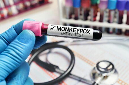 Alerta por cepa de la viruela del mono ‘con potencial pandémico’: esto se sabe de la variante símica